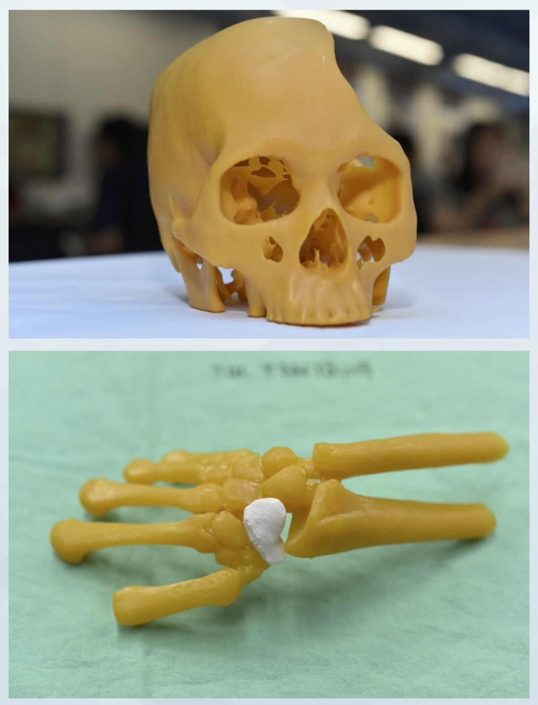 สร้างสรรค์นวัตกรรมทางการแพทย์ด้วย 3D Printing